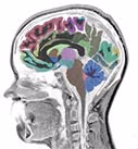 Brain volumetry segmentation